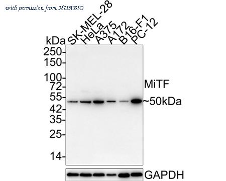 HUABIO HA750362 image 1