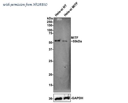 HUABIO HA750362 image 2