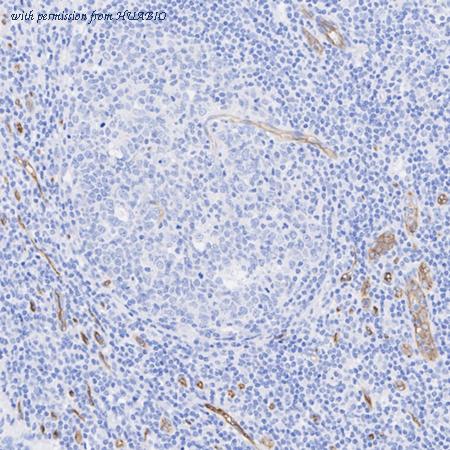 HUABIO HA750384 image 2