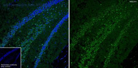 HUABIO HA750391 image 1