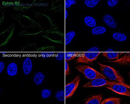 HUABIO HA750428 image 2