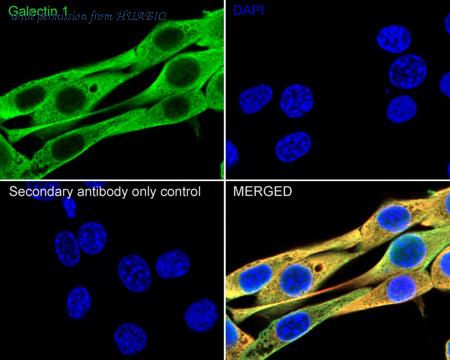 HUABIO HA750441 image 3