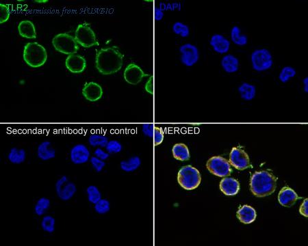 HUABIO HA750447 image 3