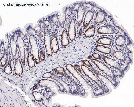 HUABIO HA750521 image 2