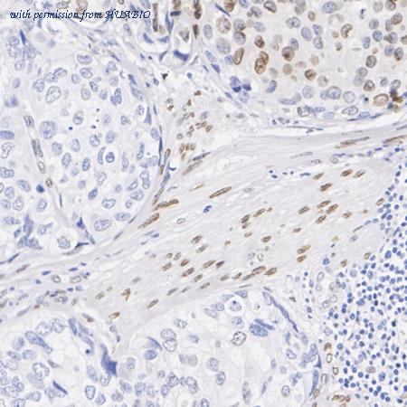 HUABIO HA750530 image 1