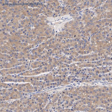 HUABIO HA750540 image 1