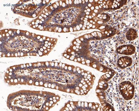 HUABIO HA750555 image 2