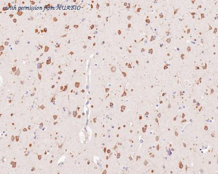 HUABIO HA750597 image 2