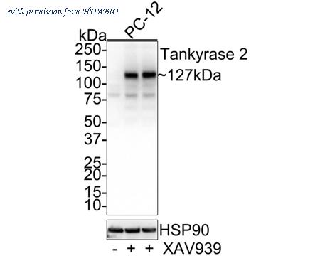 HUABIO HA750630 image 1