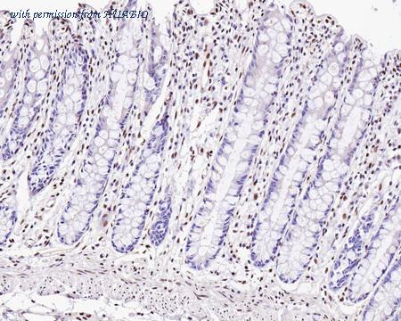 HUABIO HA750638 image 2