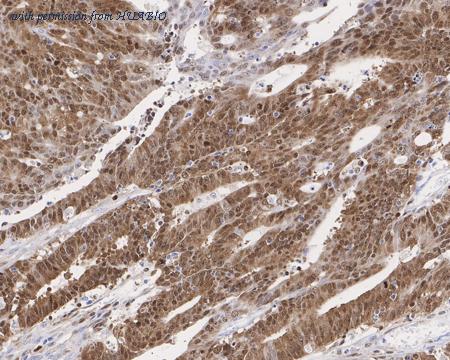 HUABIO HA750639 image 2