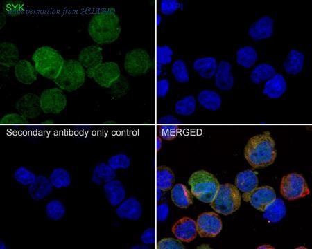 HUABIO HA750655 image 3