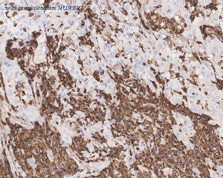 HUABIO HA750688 image 2