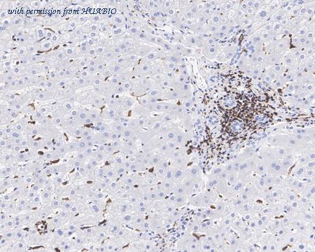 HUABIO HA750688 image 3