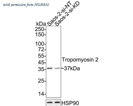 HUABIO HA750820 image 2