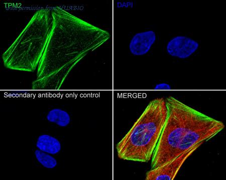 HUABIO HA750820 image 3