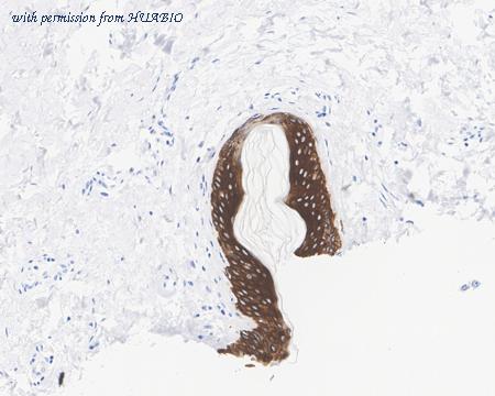 HUABIO HA750854 image 3