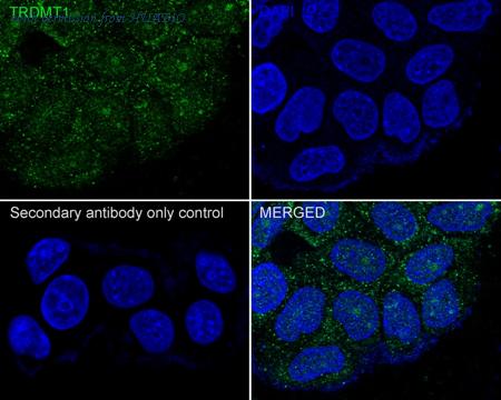 HUABIO HA750877 image 3
