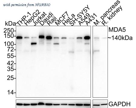 HUABIO HA750890 image 1