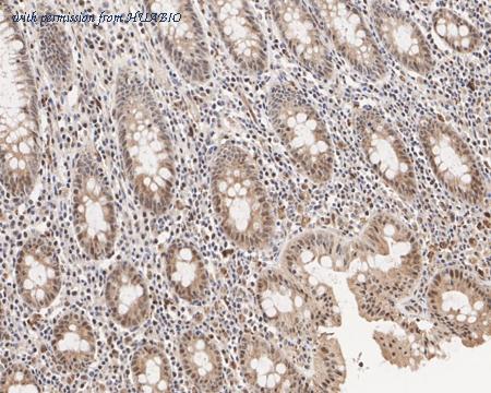 HUABIO HA750891 image 2