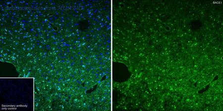 HUABIO HA750990 image 3