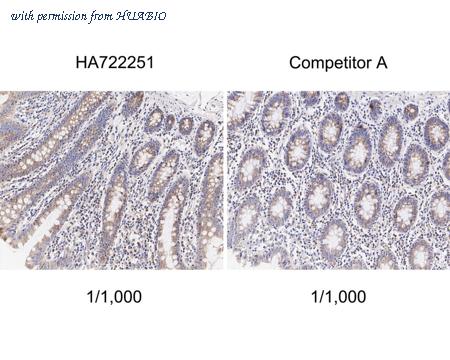 HUABIO HA750993 image 3