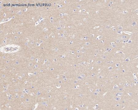 HUABIO HA750999 image 3