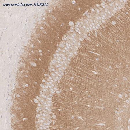 HUABIO HA751005 image 2