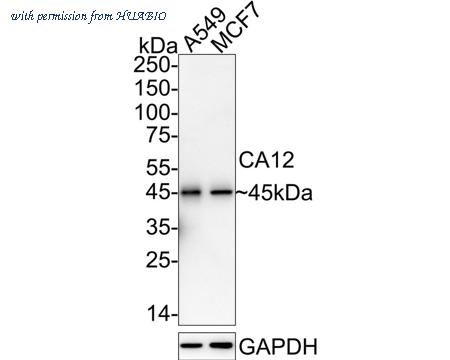 HUABIO HA751008 image 1
