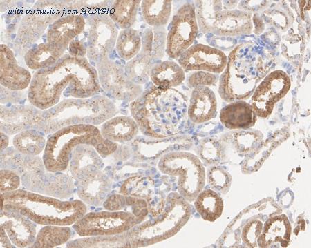 HUABIO HA751011 image 3