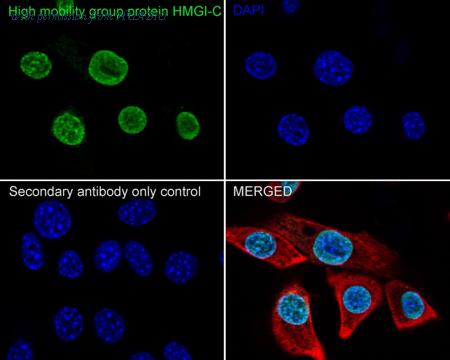 HUABIO HA751012 image 2