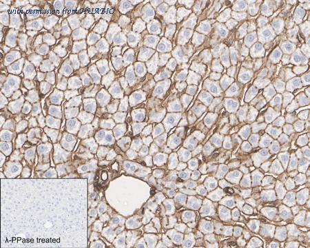 HUABIO HA751023 image 3