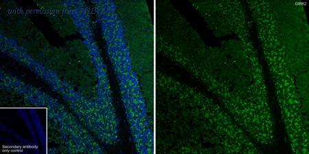 HUABIO HA751027 image 1