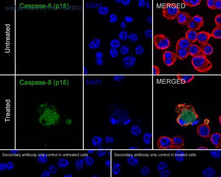HUABIO HA751031 image 2