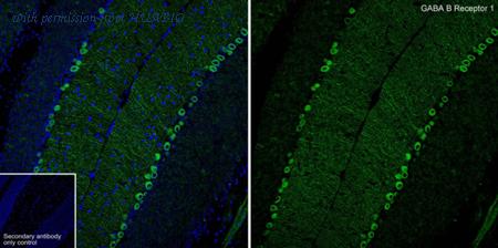 HUABIO HA751059 image 1