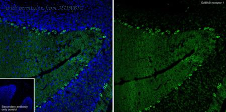 HUABIO HA751059 image 2