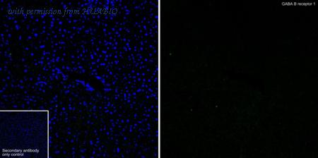 HUABIO HA751059 image 3