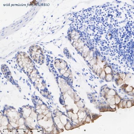 HUABIO HA751072 image 2