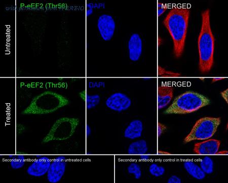 HUABIO HA751075 image 3