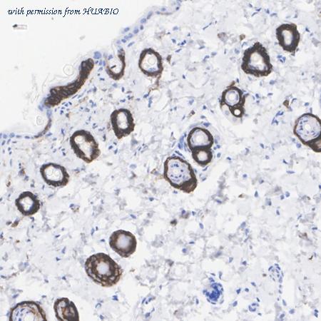 HUABIO HA751081 image 3