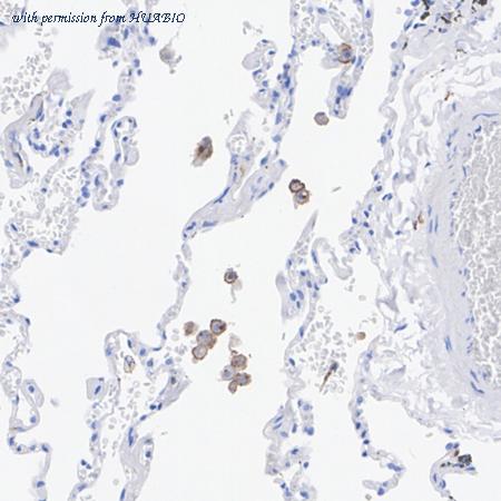 HUABIO HA751083 image 3