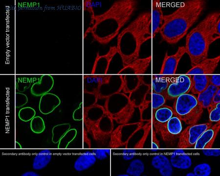 HUABIO HA751095 image 2