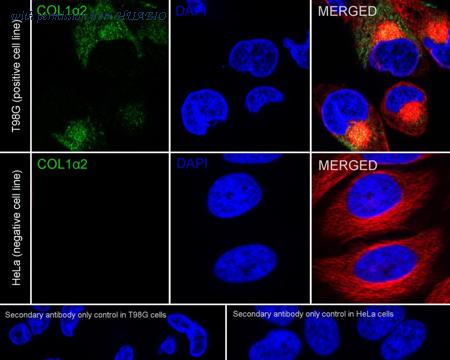 HUABIO HA751142 image 2