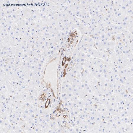 HUABIO HA751146 image 2