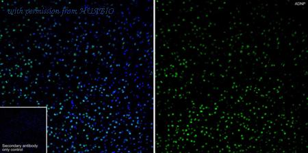 HUABIO HA751157 image 3