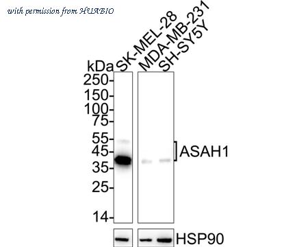 HUABIO HA751183 image 1