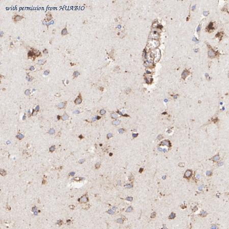 HUABIO HA751183 image 2