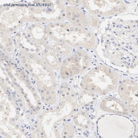 HUABIO HA751185 image 2