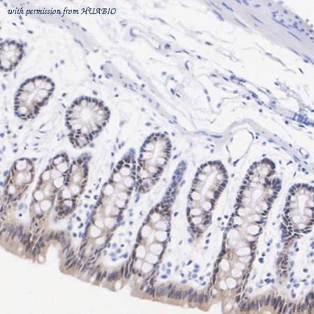 HUABIO HA751190 image 3