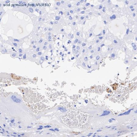 HUABIO HA751202 image 1